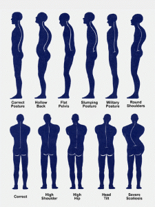 Posture examples