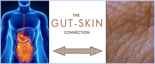 Gut Skin blog Website Banner Template - Mount Albert (600x250)