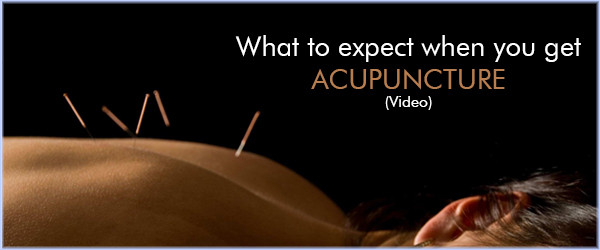 What to Expect with Acupuncture blog Website Banner Template - Mount Albert (600x250)